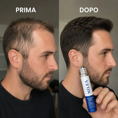 CapelloSano - Capelli Più Folti, Forti e Resistenti in 4 Settimane