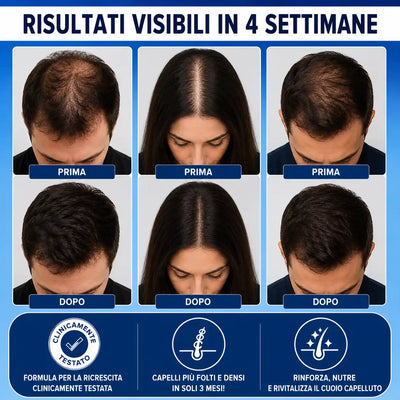 CapelloSano - Capelli Più Folti, Forti e Resistenti in 4 Settimane